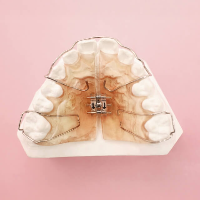 固定式・機能的矯正装置の写真